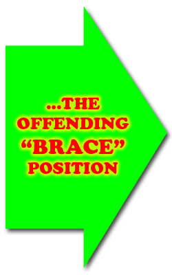 The Offending Brace Position